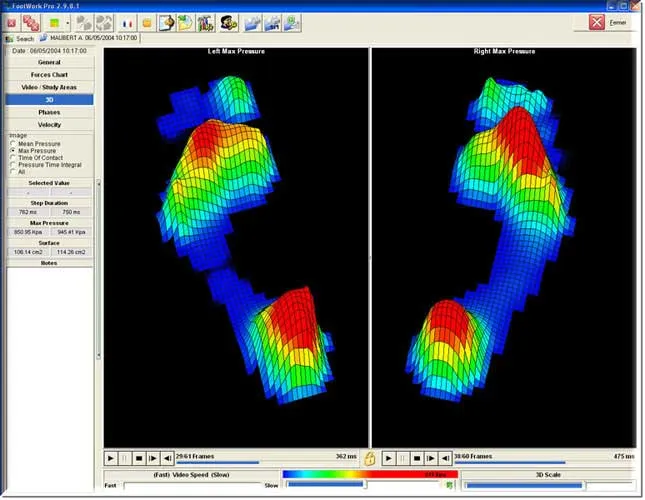 Gait Analysis image 1